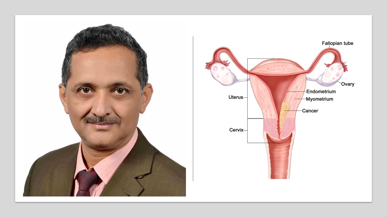 Uterine and cervical cancer in Ahmedabad Uterine and cervical cancer in Ahmedabad
